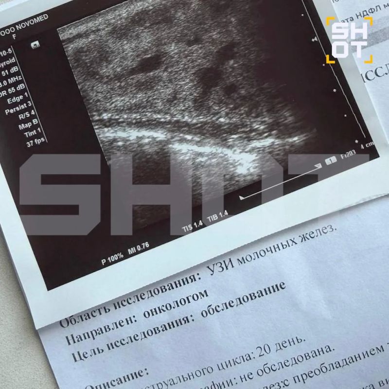У россиянки после бани развилось опасное воспаление груди, которое могло привести к абсцессу У россиянки после бани развилось опасное воспаление груди, которое могло привести к абсцессу